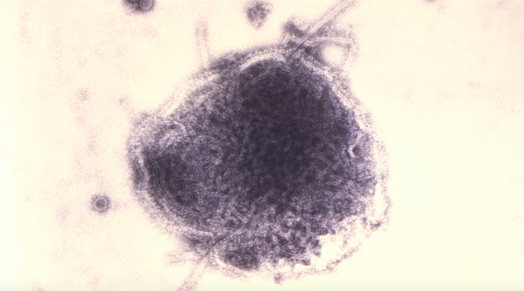 A fuzzy, oblong germ is seen under a microscope. 